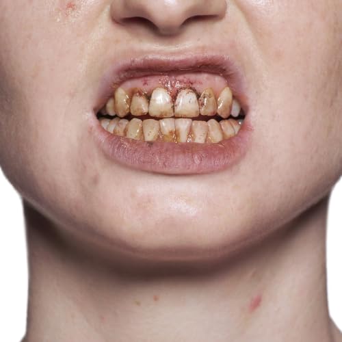 Professional Tooth Enamel, Special Effects Tooth Paint By Kryolan (Black)- Temporary Liquid Teeth Color For SFX Teeth Makeup Halloween Cosplay Theater- Blackout/ Rotten/ Tooth Decay Makeup- 0.4 Fl Oz - color: Black
