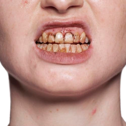 Professional Tooth Enamel, Special Effects Tooth Paint By Kryolan (Black)- Temporary Liquid Teeth Color For SFX Teeth Makeup Halloween Cosplay Theater- Blackout/ Rotten/ Tooth Decay Makeup- 0.4 Fl Oz - color: Black