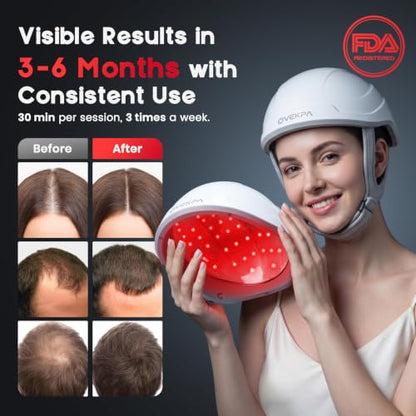 Red Light Therapy for Hair Growth - FDA Cleared Laser Cap for Hair Regrowth, Hair Loss Thinning & Alopecia Treatment for Men & Women, Wireless Rechargeable Model Hat-01 (White)