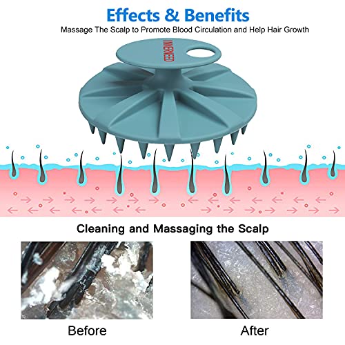 One-piece Silicone Scalp Massager Shampoo Brush Hair Wash, Gray + Green | INNERNEED Soft Bristles Scrub Head Scratcher, Head Massage Stress Relax, Wet & Dry Use for Thick Thin Curly Hair Care - color: Green